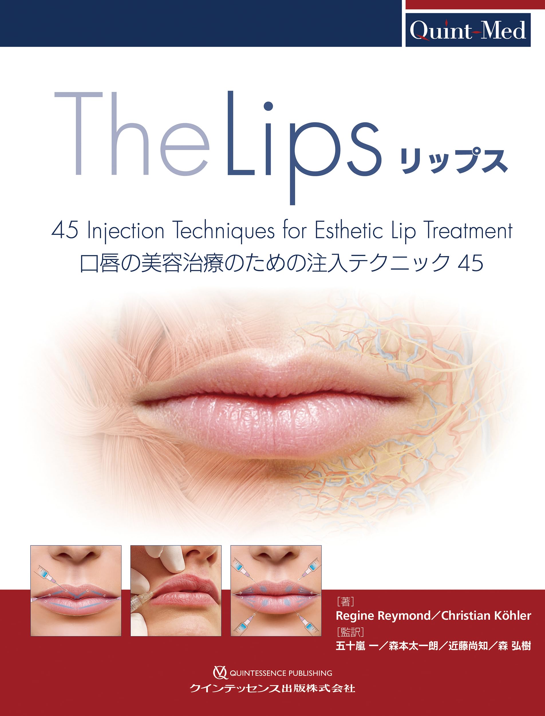 リップス 口唇の美容治療のための注入テクニック45 （Quint-Med） リップス: 口唇の美容治療のための注入テクニック45 (Quint-Med
